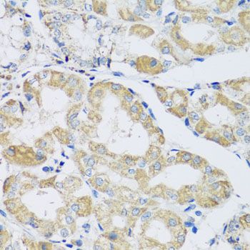 Immunohistochemistry - ATPIF1 Polyclonal Antibody (144-05099)