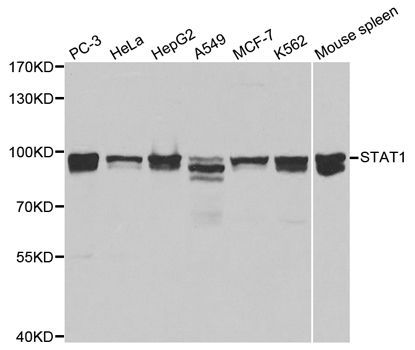 Western blot - STAT1 Polyclonal Antibody (144-00027)