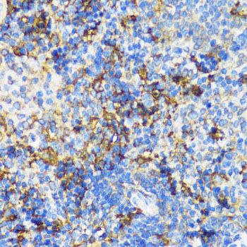 Immunohistochemistry - NAMPT Polyclonal Antibody (144-00256)