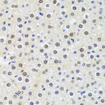 Immunohistochemistry - MTAP Polyclonal Antibody (144-01049)