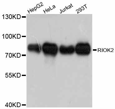 Western blot - RIOK2 antibody (144-012122)