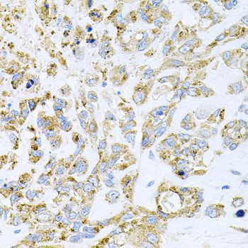 Immunohistochemistry - HDAC3 antibody (144-012542)