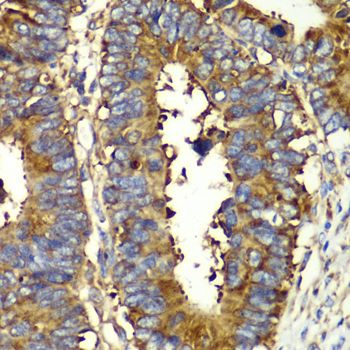 Immunohistochemistry - QARS antibody (144-06960)