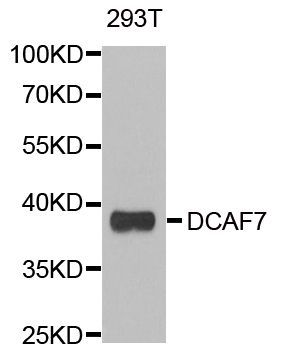 Western blot - DCAF7 Polyclonal Antibody (144-06787)