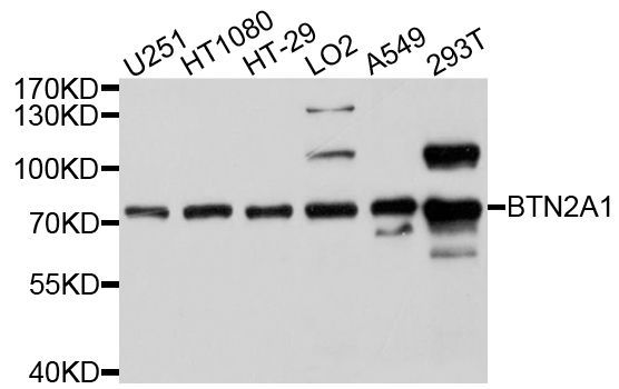 Western blot - BTN2A1 Polyclonal Antibody (144-10418)