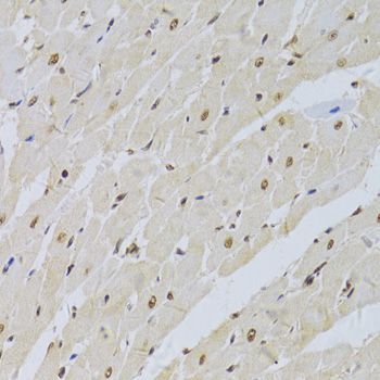 Immunohistochemistry - SNRPA Antibody (144-06410)