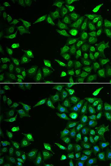 Immunofluorescence - INTS6 antibody (144-06634)