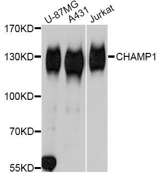 Western blot - CHAMP1 Polyclonal Antibody (144-011690)