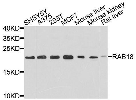 Western blot - RAB18 antibody (144-02812)
