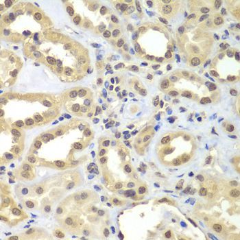 Immunohistochemistry - SUPT20H Polyclonal Antibody (144-07374)