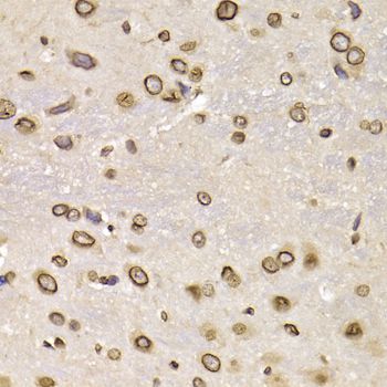 Immunohistochemistry - LMNB2 Polyclonal Antibody (144-06483)
