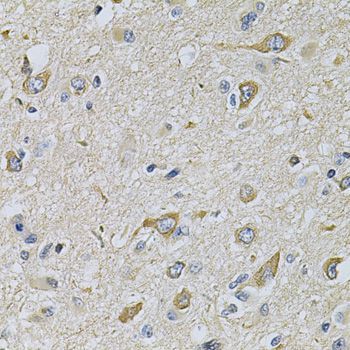 Immunohistochemistry - RAB17 Antibody (144-07831)