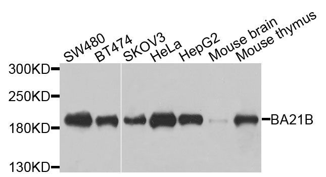 Western blot - [KO Validated] BAZ1B Polyclonal Antibody (144-09851)