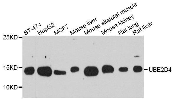 Western blot - UBE2D4 antibody (144-08332)