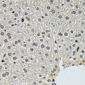 Immunohistochemistry - PNKP antibody (144-06693)