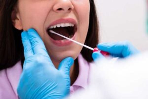 The back of the throat or nasal cavity is swabbed for SARS-CoV-2 viral RNA detection