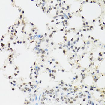 Immunohistochemistry - EDF1 Polyclonal Antibody (144-02283)
