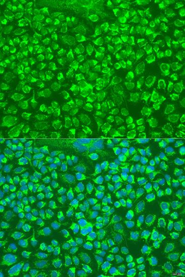 Immunofluorescence - GZMA Polyclonal Antibody (144-06231)