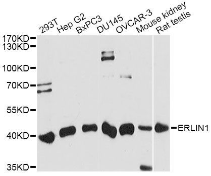 Western blot - ERLIN1 antibody (144-60819)