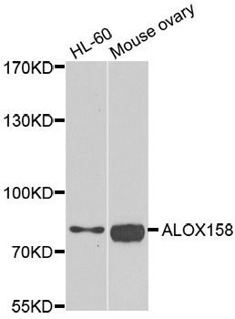 Western blot - ALOX15B Polyclonal Antibody (144-06865)