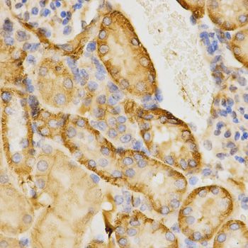 Immunohistochemistry - CDC42 Antibody (144-01188)