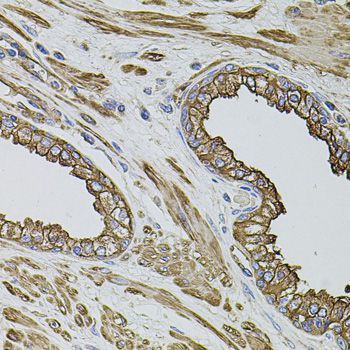 Immunohistochemistry - FLNB Polyclonal Antibody (144-02481)