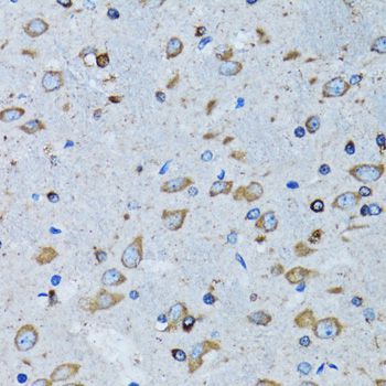 Immunohistochemistry - RARS antibody (144-06307)