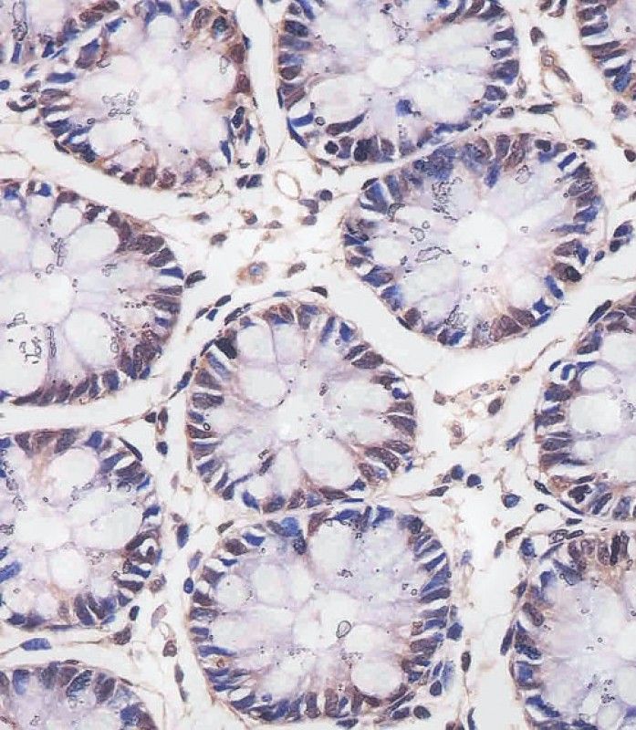 IHC-P