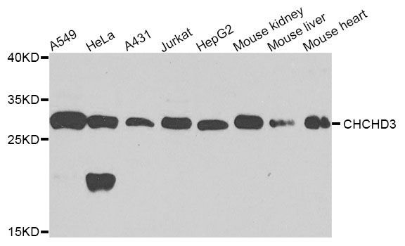 Western blot - CHCHD3 Polyclonal Antibody (144-08584)