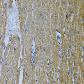 Immunohistochemistry - AK1 Polyclonal Antibody (144-603440)