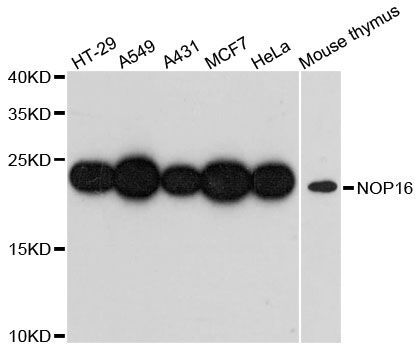 Western blot - NOP16 antibody (144-60450)
