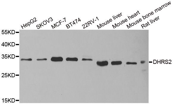 Western blot - DHRS2 antibody (144-06446)
