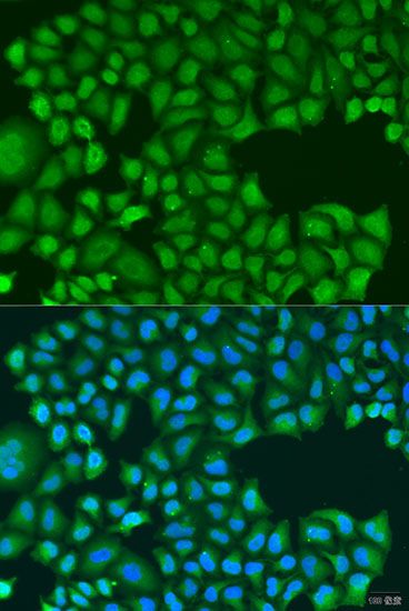 Immunofluorescence - TIRAP antibody (144-12606)