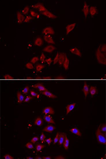 Immunofluorescence - NPHP1 Polyclonal Antibody (144-06674)