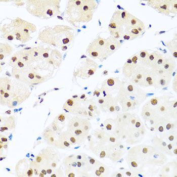 Immunohistochemistry - RAB3IP Polyclonal Antibody (144-08094)