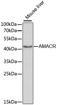 Western blot - AMACR antibody (144-01130)