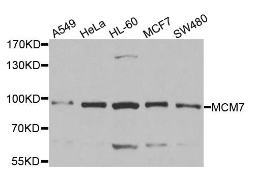 Western blot - MCM7 antibody (144-01138)