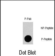DB
