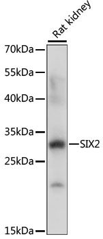 Western blot