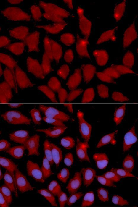 Immunofluorescence - DNMT3A antibody (144-02065)
