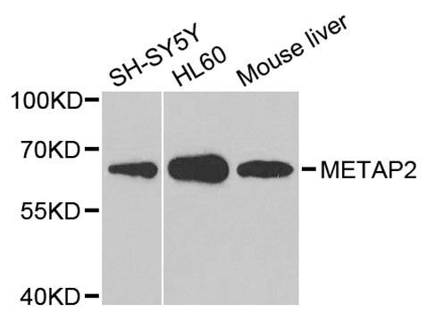Western blot - METAP2 antibody (144-05962)