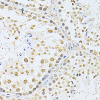 Immunohistochemistry - AKT1 Polyclonal Antibody (144-011016)