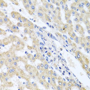 Immunohistochemistry - ITPKB antibody (144-03929)