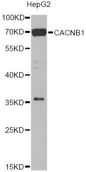 Western blot - CACNB1 Antibody (144-07649)
