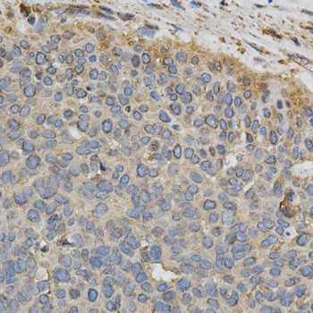 Immunohistochemistry - CYP1A1 antibody (144-02159)
