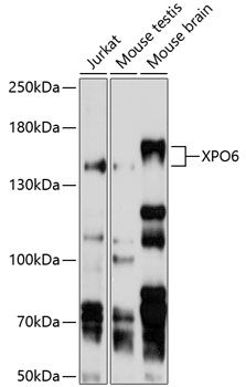 Western blot