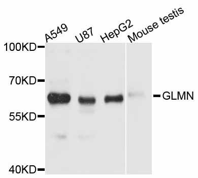 Western blot - GLMN antibody (144-012025)