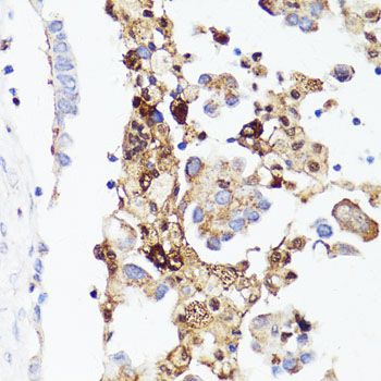Immunohistochemistry - CD4 Polyclonal Antibody (144-60019)