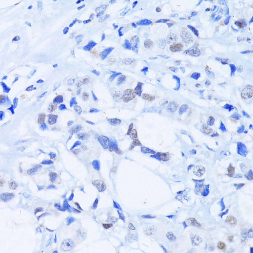 Immunohistochemistry - PARP1 Polyclonal Antibody (144-00942)