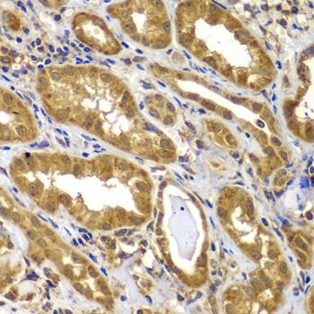 Immunohistochemistry - MMP14 antibody (144-02549)